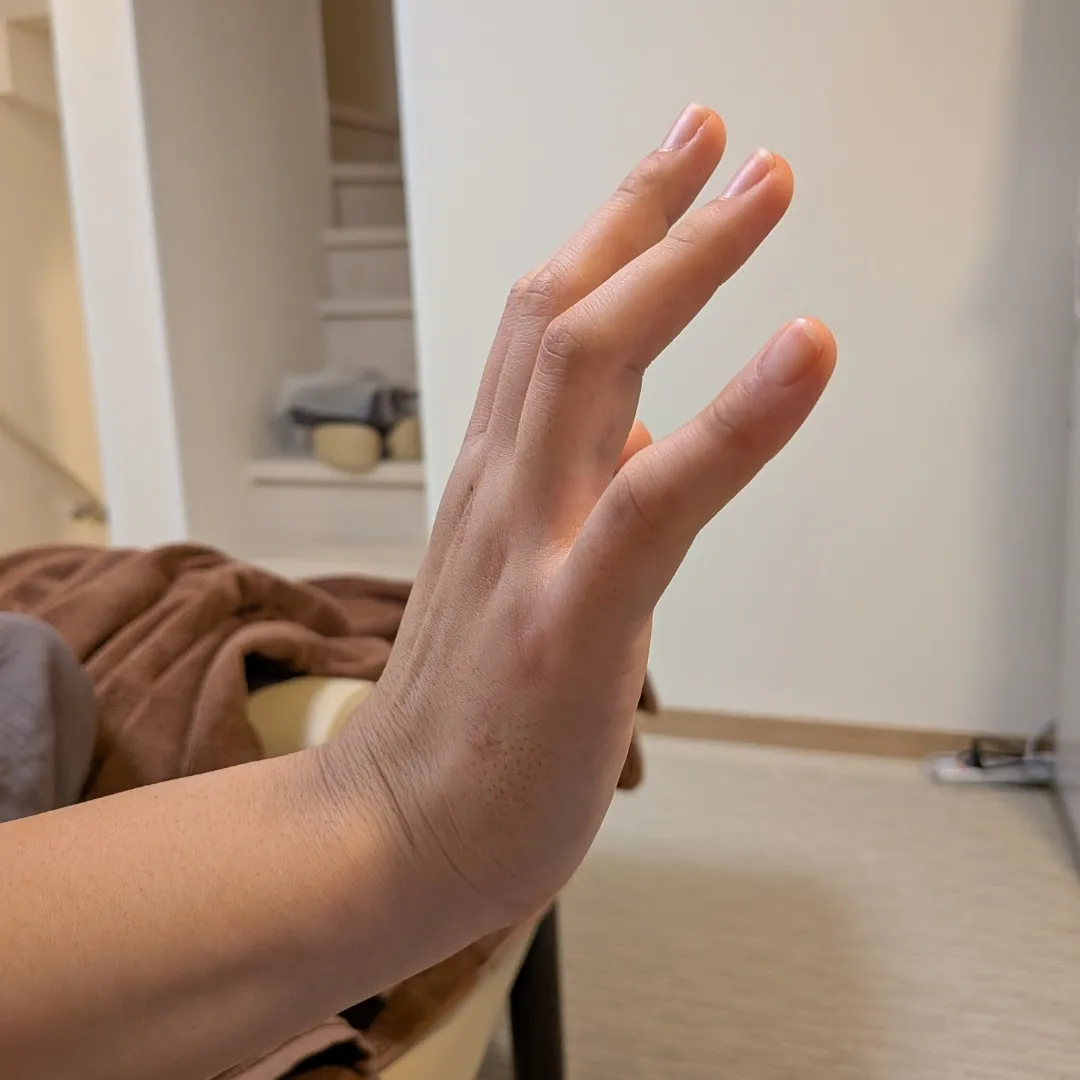 手首の痛み