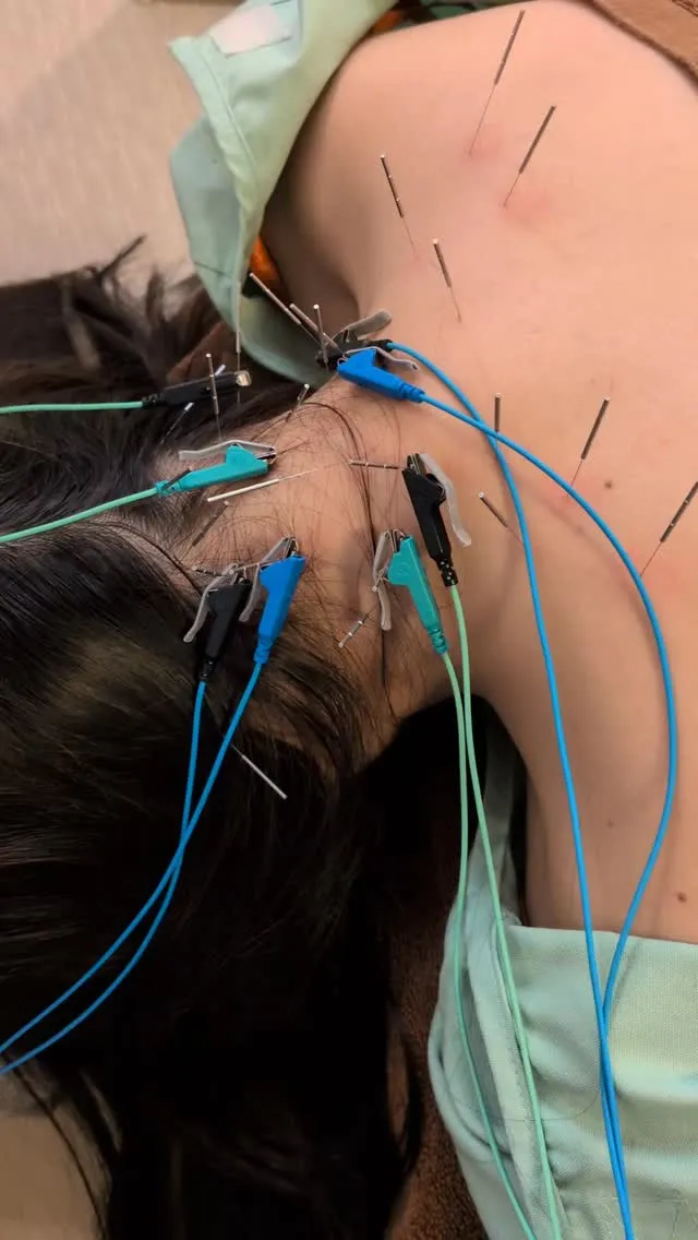 デスクワークによる頭痛